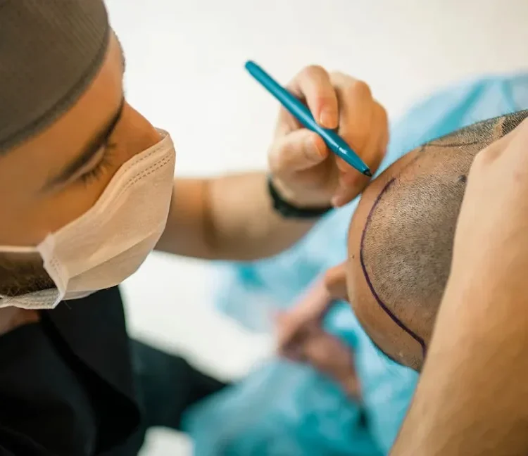Hair restoration