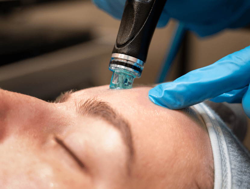 HydraFacial Treatment in Delhi