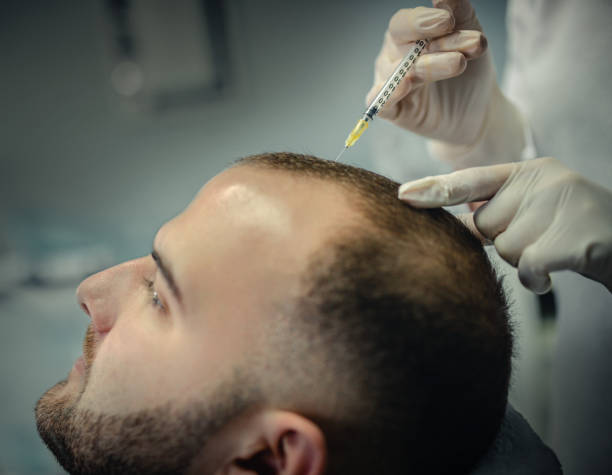 Hair Transplant in Delhi by Dr Vivek Gupta